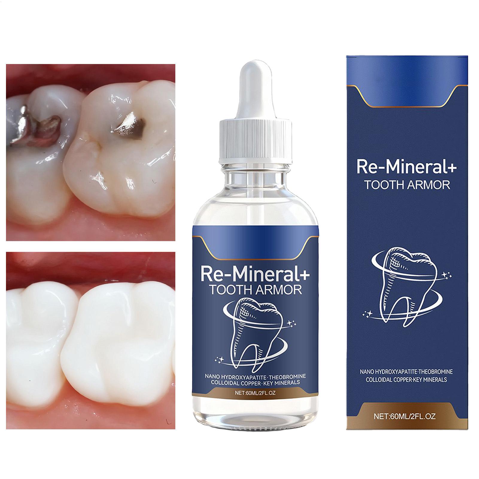 Teeth Whitening Gum - Líquido de limpieza dental de 60