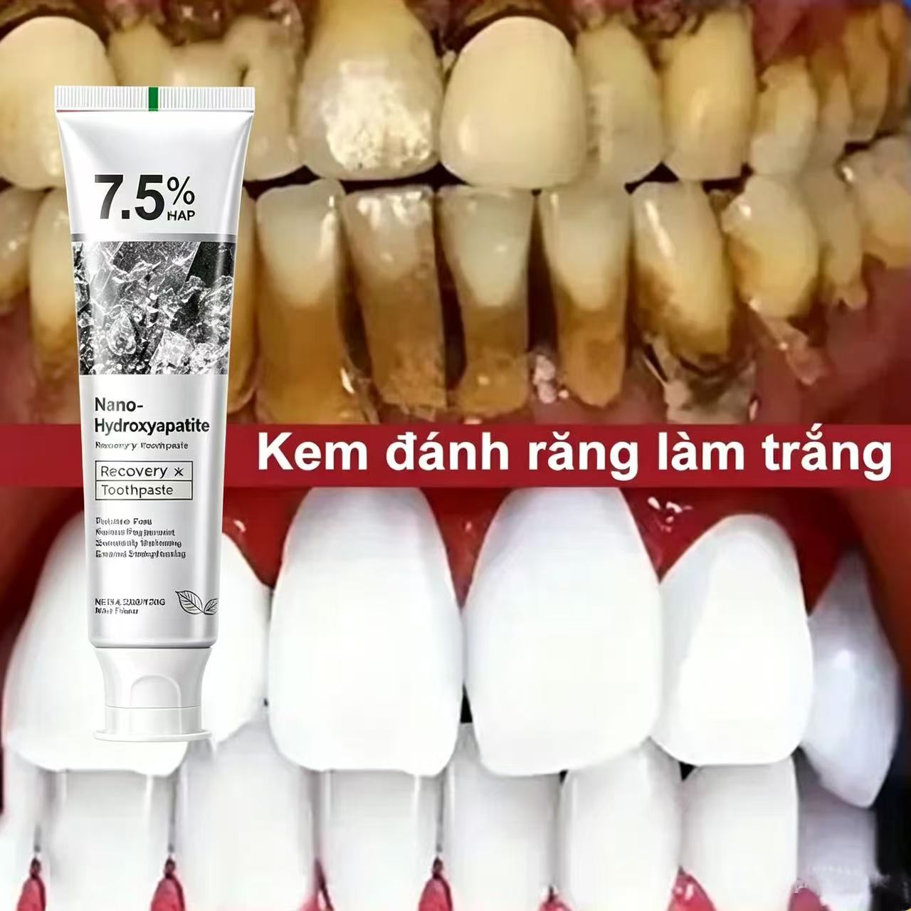 Teeth Whitening Best - Pasta Dental Blanqueadora Probiótica con 7.5%