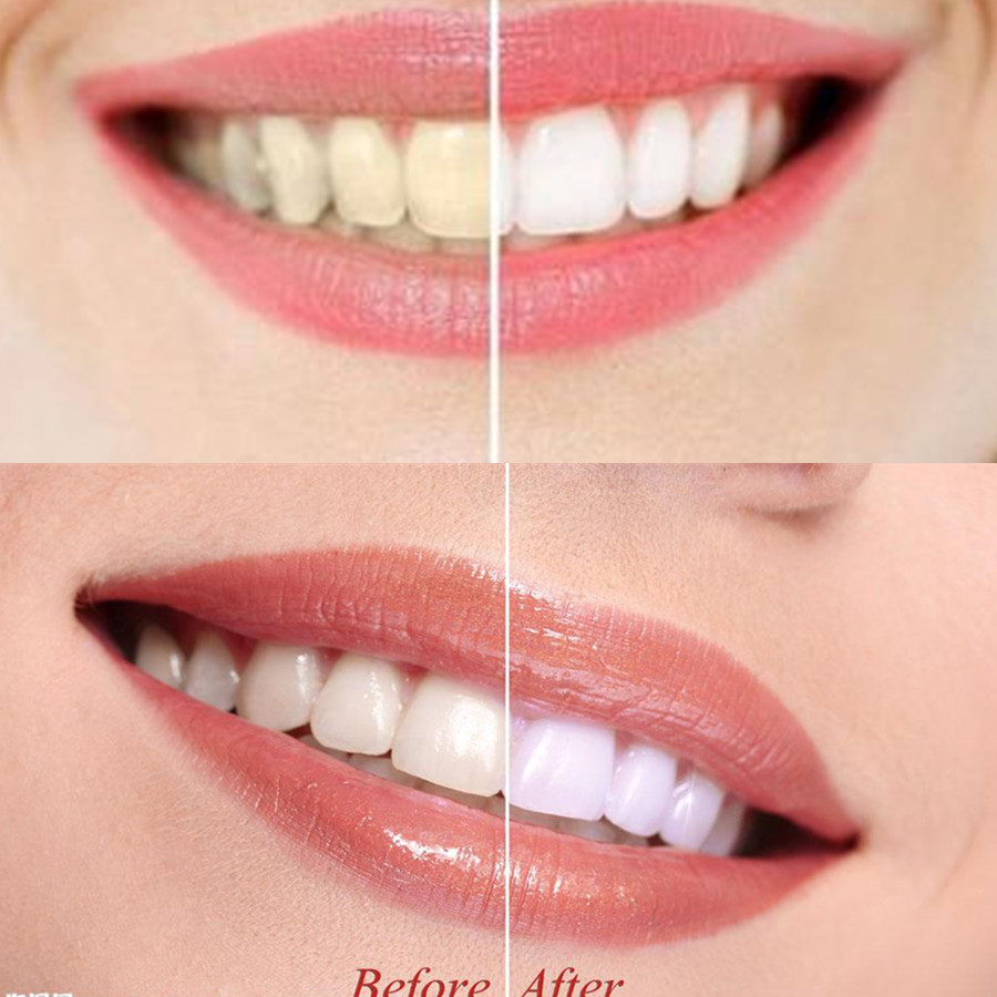Dientes de carbón de bambú par - Teeth Whitening Powder reseña y precio