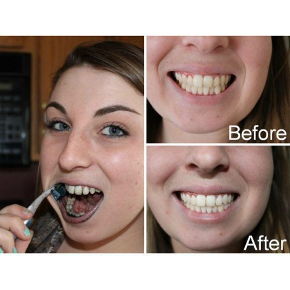 Dientes de carbón de bambú par - Teeth Whitening Powder reseña y precio