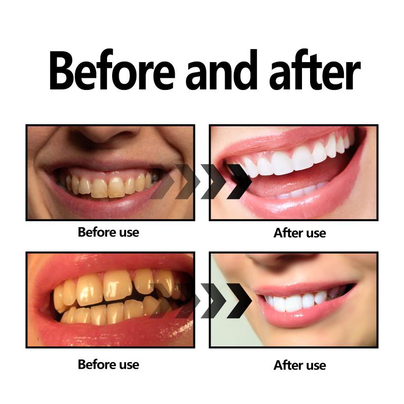 Polvo de Carbón de Bambú para  - Teeth Whitening Filter reseña y precio