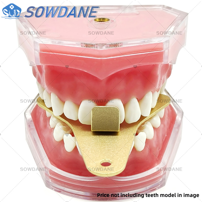 Bandejas de impresión de labor - Teeth Whitening Tray reseña y precio