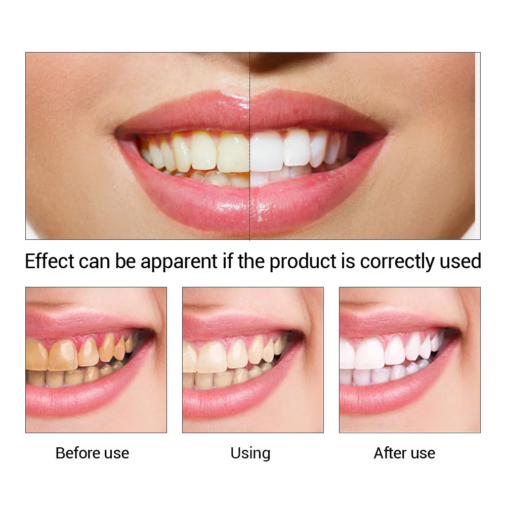 FTEENPLY-esencia para blanquea - Teeth Whitening Powder reseña y precio