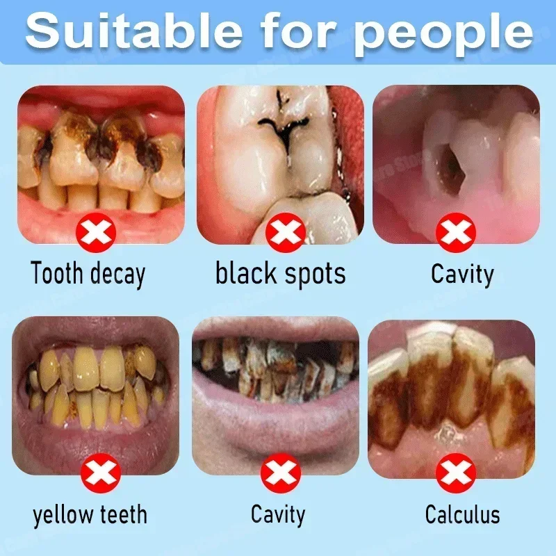 Pasta Dental Anticaries que Re - Teeth Whitening Best reseña y precio