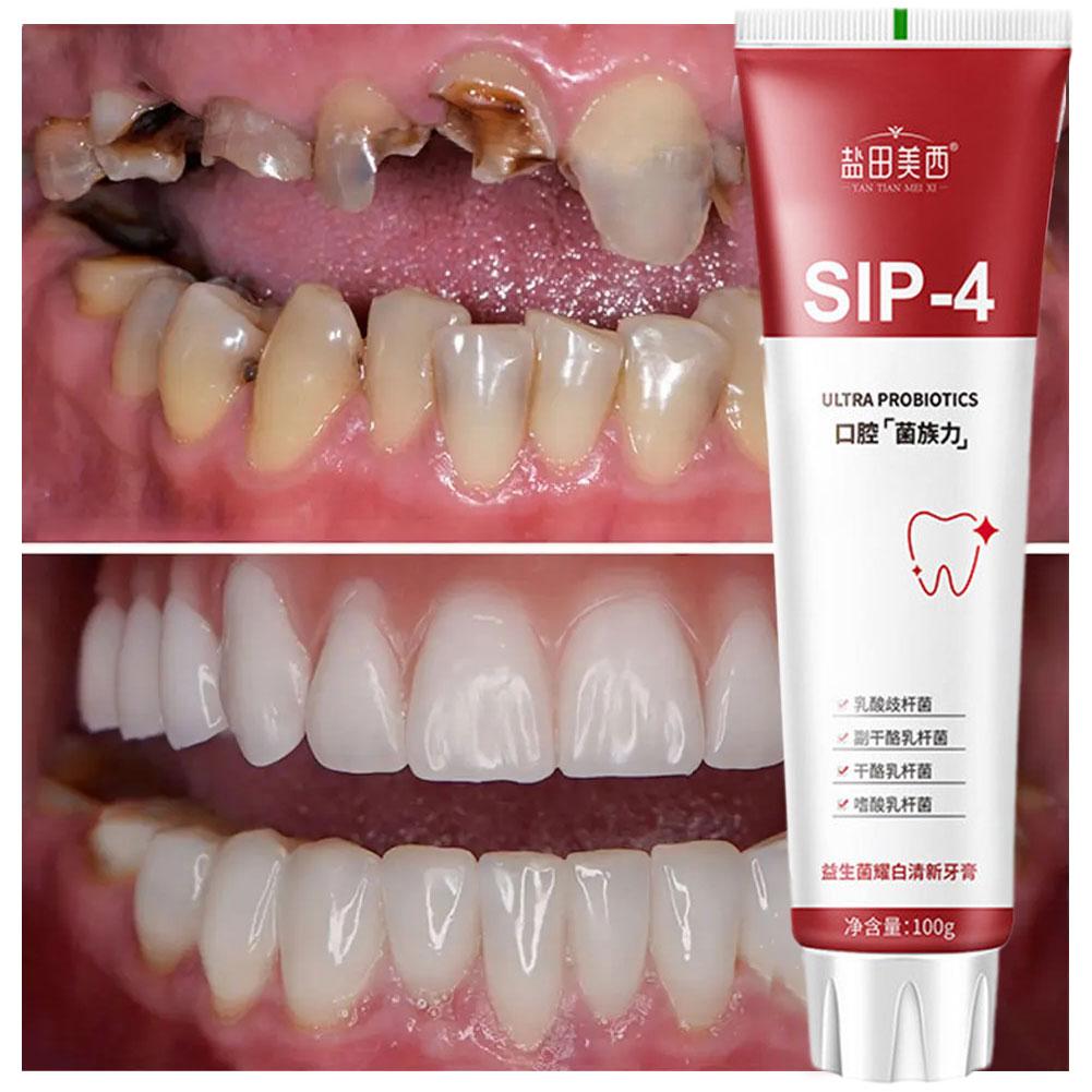 Pasta Dental Blanqueadora Prob - Teeth Whitening Best reseña y precio