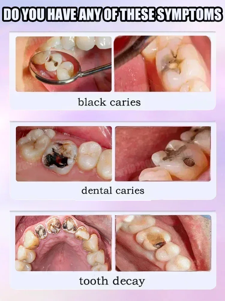 Ventas calientes Más vendido,  - Teeth Whitening Best reseña y precio