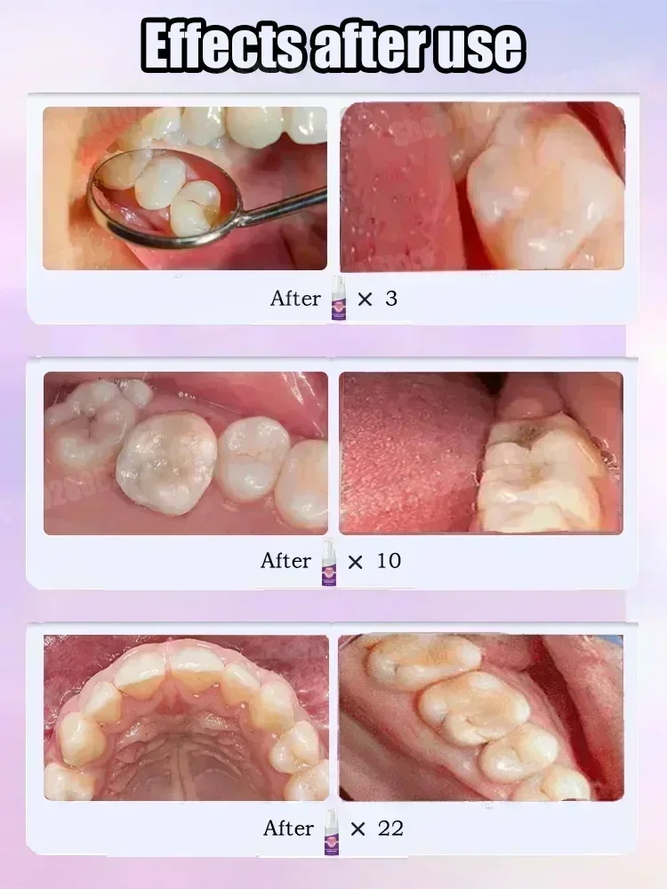 Pasta de dientes para limpieza - Teeth Whitening Best reseña y precio